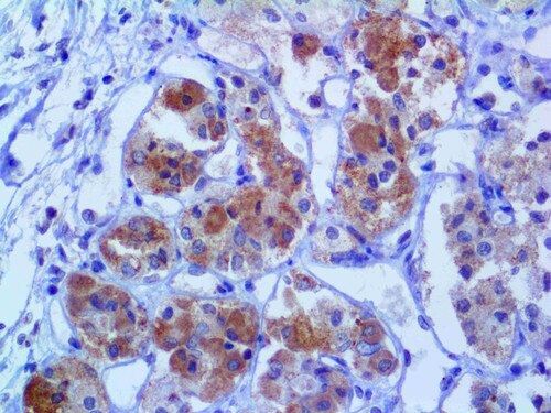 IHC of LH on an FFPE Pituitary Adenoma Tissue